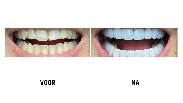 Restyle Your Smile