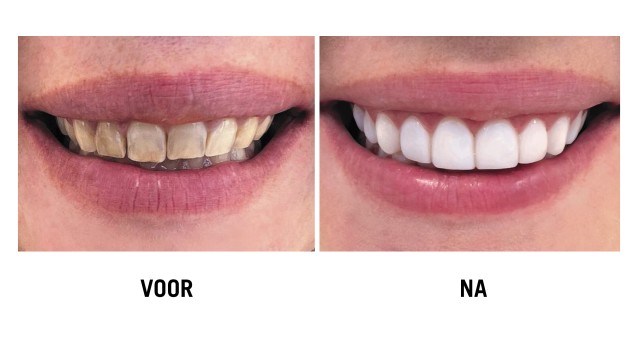 Dental&Co