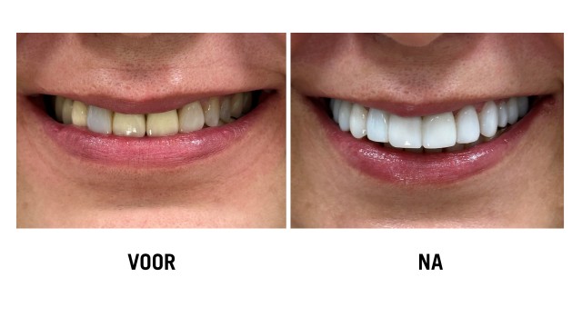 Dental&CO2