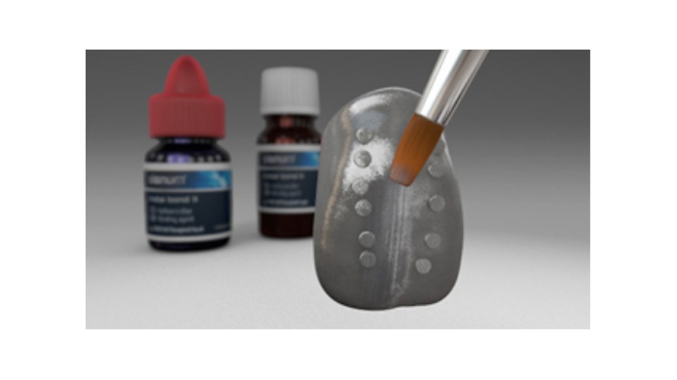 Bonding systemen Veneer composiet