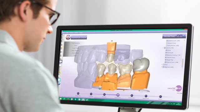 Kulzer CAD-CAM 