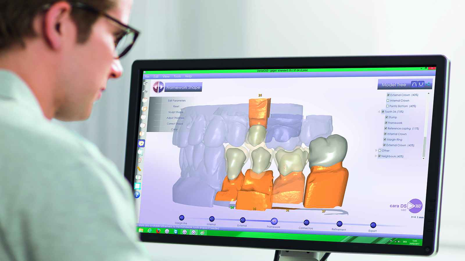 CAD-CAM Lab Processes